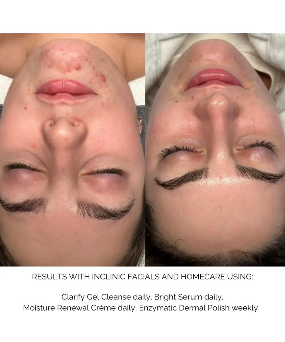 Clarify Gel Cleanser