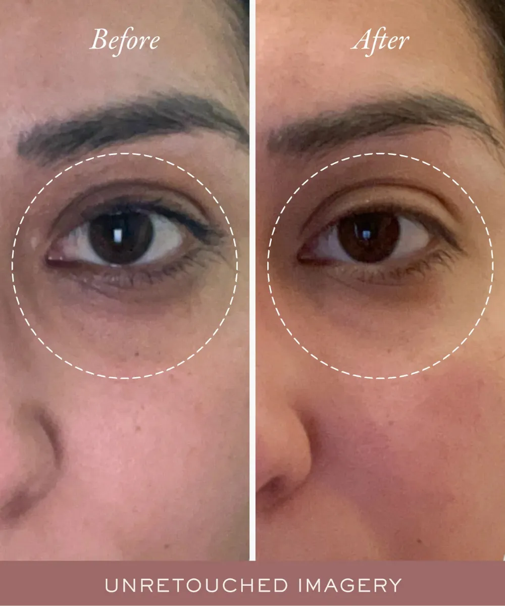 Golden Glow Eye Balm