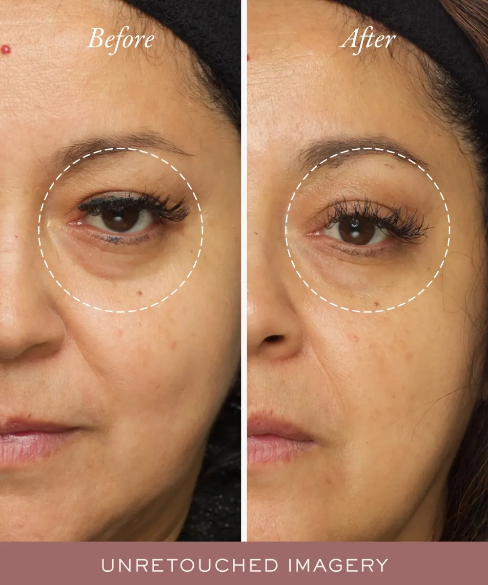 Radiance Face Serum